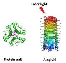 Lasers might be the cure for brain diseases