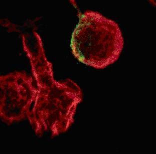 Wie HIV die Immunzellen laehmt