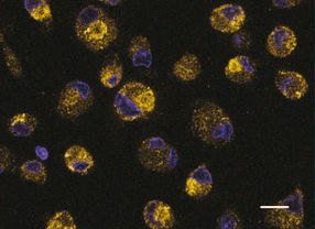 Neuer Abwehrmechanismus des Immunsystems gegen HI-Viren entdeckt