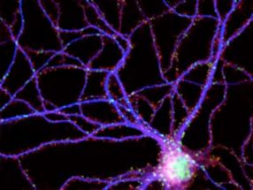 Gene found to be crucial for formation of certain brain circuitry