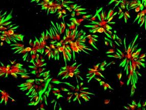 Human stem cells predict efficacy of Alzheimer drugs