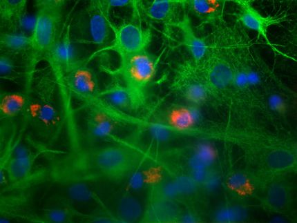 Anti-epilepsy drugs can cause inflammations