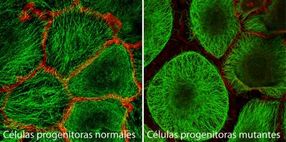 'Molecular scaffolding' that maintains skin structure and organisation