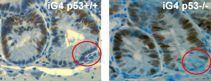 Schutzmechanismus gegen das Altern entdeckt