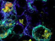 Typhoid fever – A race against time