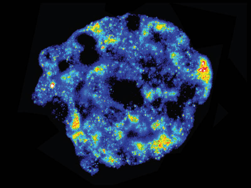 Mit Mathematik einzigartige Zellen aufspüren - Statistische Methoden verbessern biologische Einzelzell-Analyse