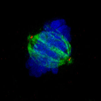 Impaired cell division leads to neuronal disorder