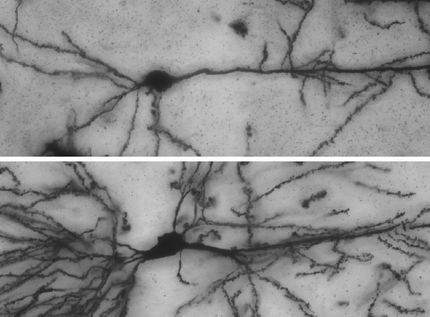 Wie Nervenzellen wachsen