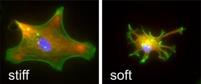 Filling me softly - New study shows implant stiffness is a major cause of foreign body reactions