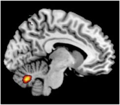 How memory and schizophrenia are connected