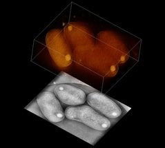 3D-Kryo-Elektronenmikroskopie: Neues Verfahren für Beobachtung der Zellstruktur