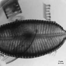 Brillante Funken für die Röntgenmikroskopie zur dreidimensionalen Aufnahme biologischer Zellen