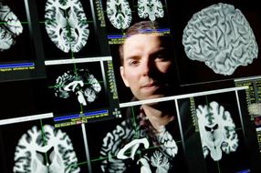 One gene influences recovery from traumatic brain injury