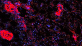 B-Zellen verstärken Autoimmunerkrankungen