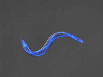 Alzheimer: N-Acetylgucosamin verhindert Verklumpung von Proteinen