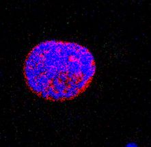 CT45 - ein neues Tumor Antigen