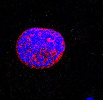 CT45 - ein neues Tumor Antigen