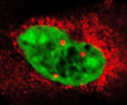 MHHNeuroanatomen entdecken molekularen Mechanismus fuer die Regulation der Zellkernstruktur