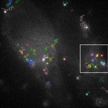 Automatic tracking of biological particles in cell microscopy images