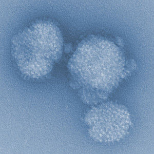Schwer erkranken, um schneller gesund zu werden - Forscher finden mögliche Ursache für längeren Grippeverlauf bei älteren Menschen