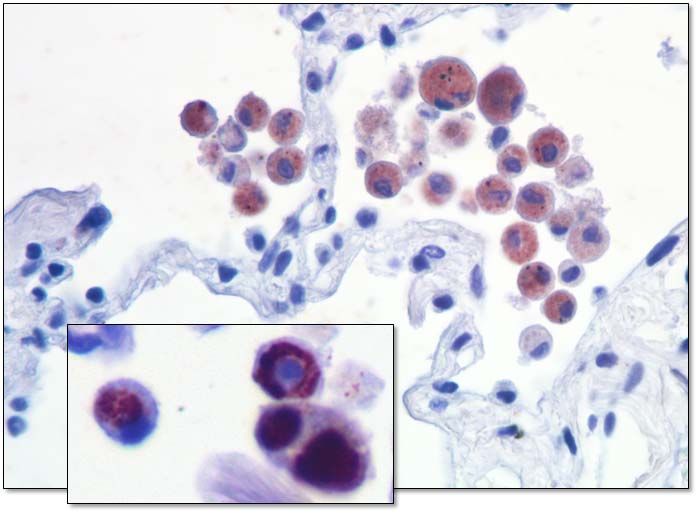 TU Braunschweig/Zelluläre Infektionsbiologie