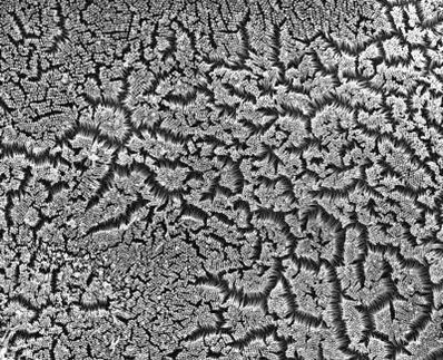 How intestinal cells build nutrient-absorbing surface