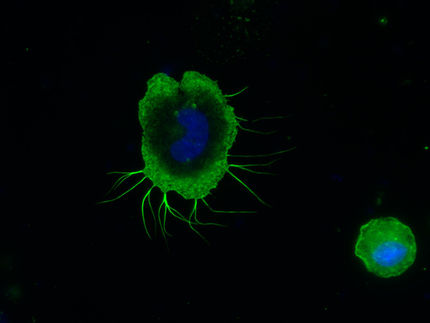 Immune cell-test on the International Space Station