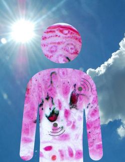 Exact outline of melanoma could lead to new diagnostic tools