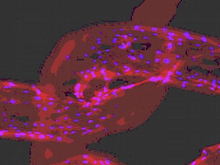 Forschern gelingt Besiedlung eines Textilimplantates mit humanen Stammzellen