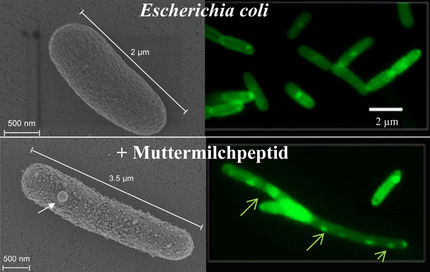 Antibiotikum aus Muttermilch: Forscher entdecken neue Waffe gegen Bakterien