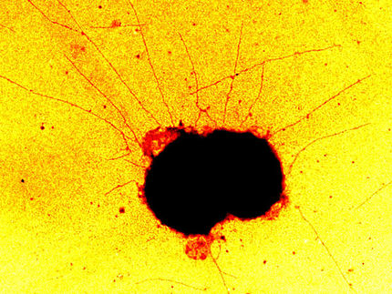 Neisseria gonorrhoeae