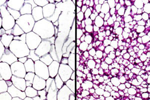 Epigenetisches Enzym steuert Fettbildung