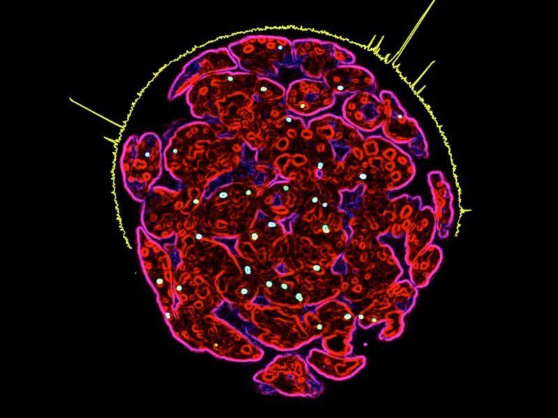 © MPI f. Immunobiology and Epigenetics/ Tomasz Chelmicki