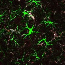 Protein associated with Huntingtons disease