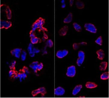 nuclear envelopes from induced pluripotent stem cells