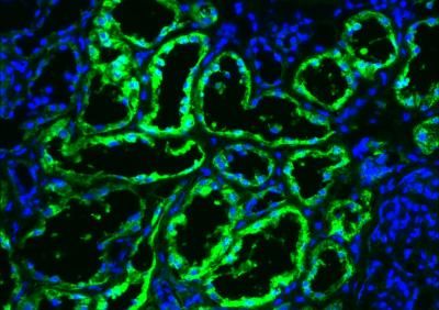 Primary human kidney tissue