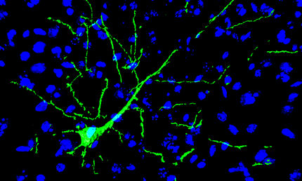 Implantierte Nervenzellen werden Teil des Gehirns