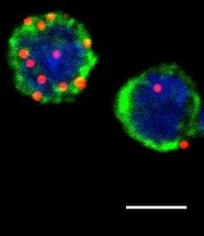 Angeborene lymphoide Zellen lösen Abwehrreaktion von T-Zellen aus