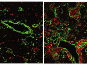 Immunsystem um 500 Millionen Jahre zurückgedreht