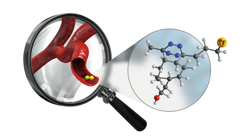 Innovative Methode zur molekularen Bildgebung - AIT und TU Wien entwickeln neues Verfahren