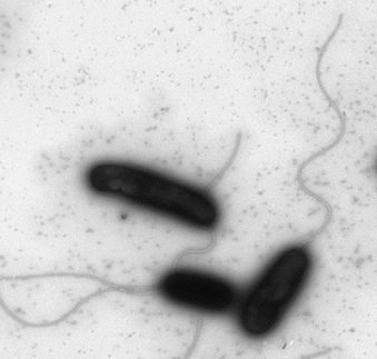 Forscher entwaffnen Cholera-Erreger: Bakterium erkennt Menschen an der Körpertemperatur