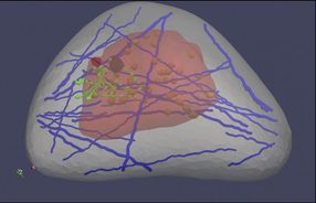 'Virtual breast' could improve cancer detection