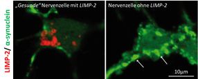 Ablagerungen beseitigen: Forscher finden Zusammenhang von Transportprotein mit Parkinson
