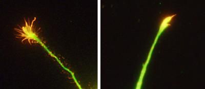Hata, K., et al. 2009. J. Cell Biol. doi:10.1083/jcb.200807029.