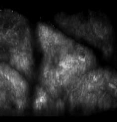 Measuring Skin Rejuvenescence