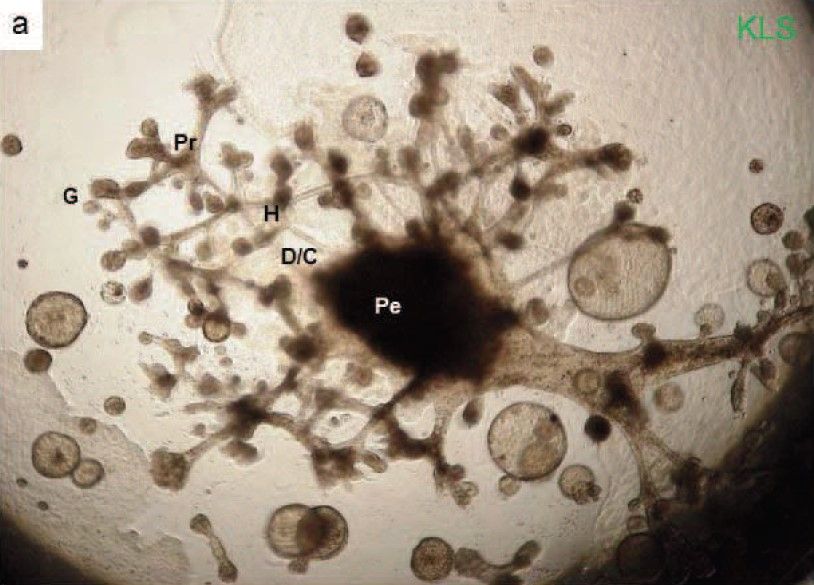 KS cell cluster formed a kidney-like structure