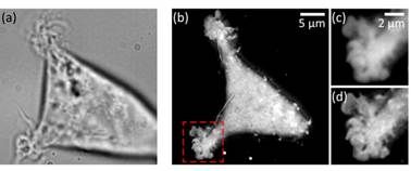 Membrane nano-tomography in living cells