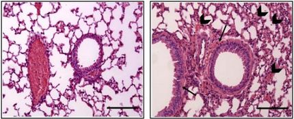 Airways of Male and Female Mice Respond Differently to Anaphylactic Triggers