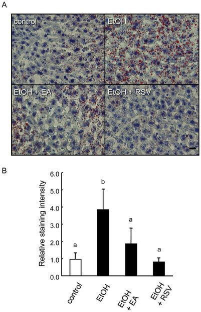 Effect of polyphenols on alcohol-induced fatty liver in mice
