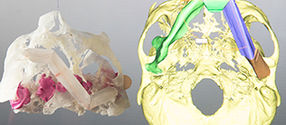 3D-Drucker bildet menschliche Körperteile exakt nach